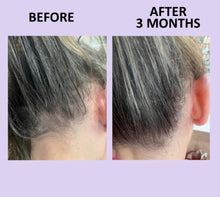 Load image into Gallery viewer, GLOWWA HAIR FOOD™ MENO THREE-MONTH SUPPLY
