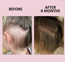 Load image into Gallery viewer, GLOWWA HAIR FOOD™ THREE-MONTH SUPPLY
